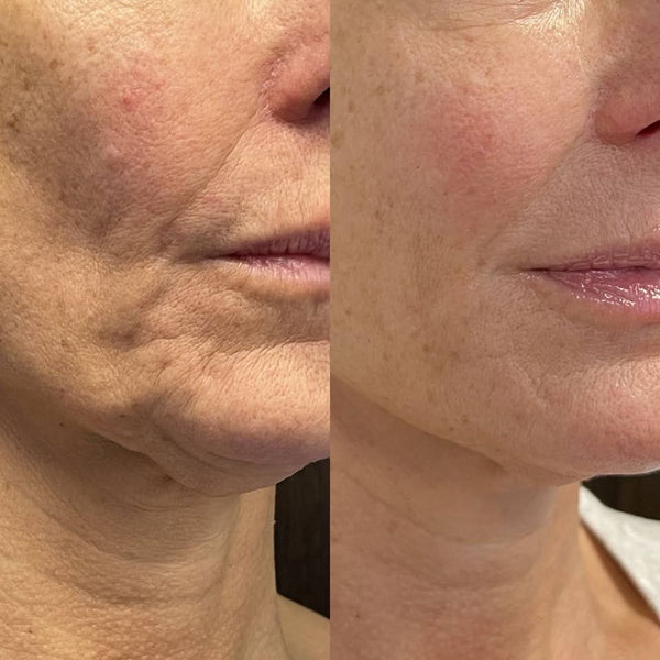 Before and after skin transformation