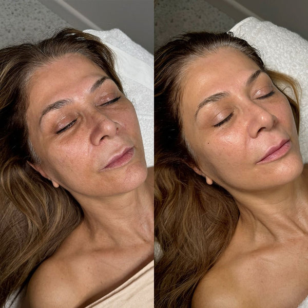 Before and after skin transformation